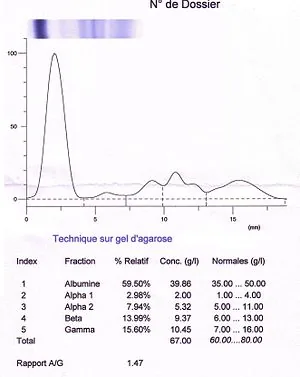 Predicting diseases from serum-protein electrophoresis images